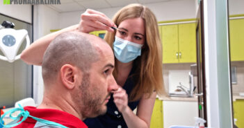 Wie funktioniert eine Haartransplantation?